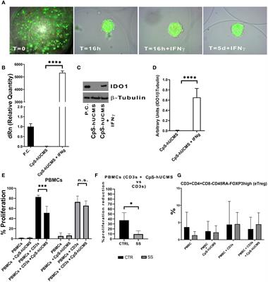 Emerging of a new CD3+CD31HCD184+ tang cell phenothype in Sjögren’s syndrome induced by microencapsulated human umbilical cord matrix-derived multipotent stromal cells